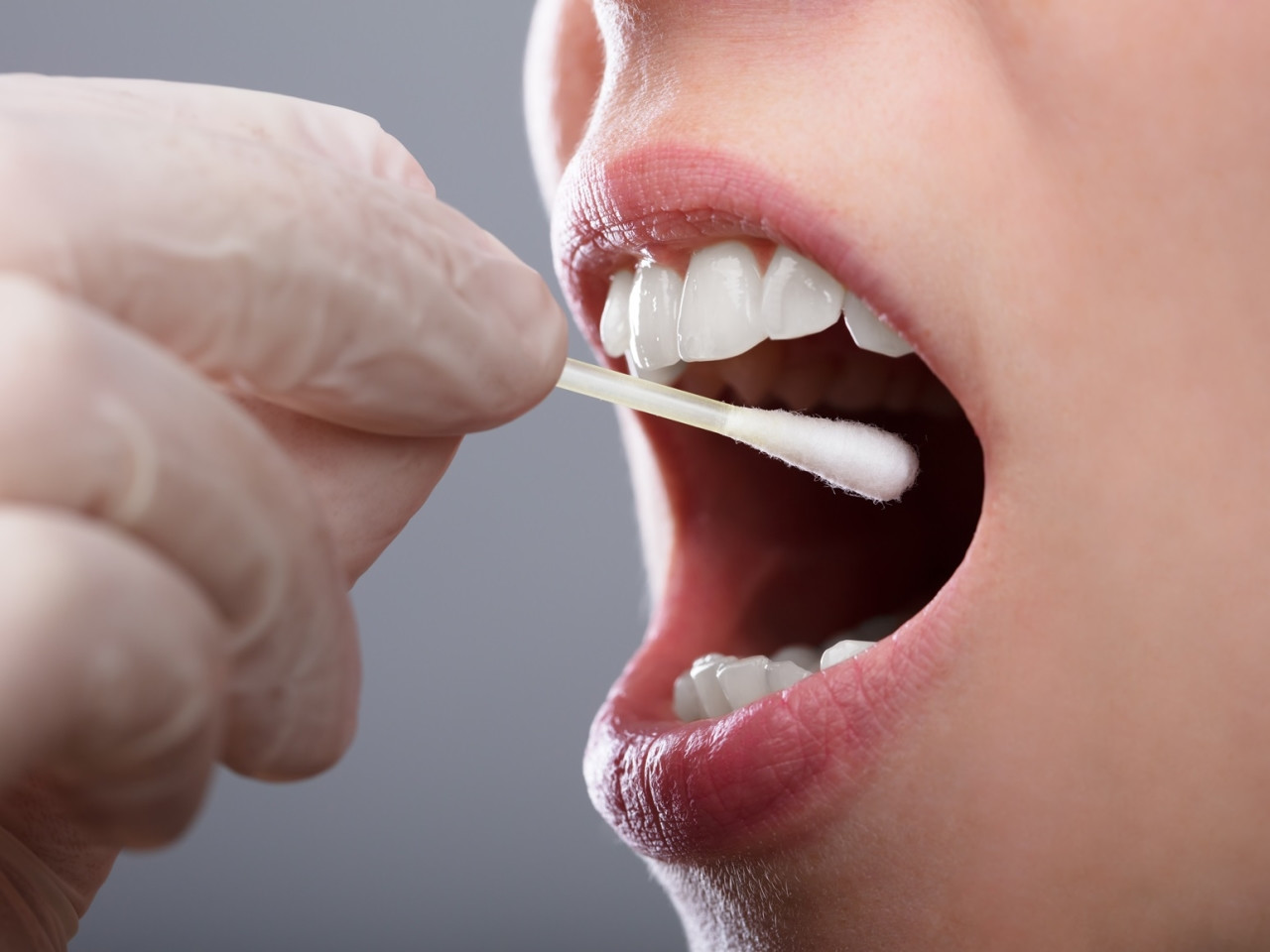 Test del pH salivare | Dentisti Trapani Di Maio Sorrento